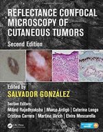 Reflectance Confocal Microscopy of Cutaneous Tumors 2nd Edition, ISBN-13: 978-1498757607